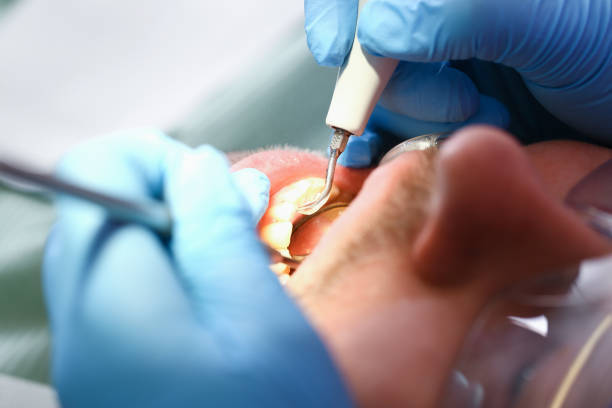 Best Urgent Dental Care for Toothaches in Napa, CA