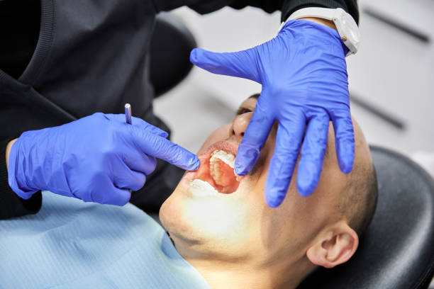 Best Emergency Treatment for Oral Infections in Napa, CA