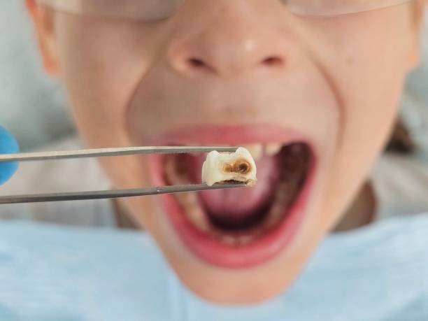 Best Emergency Orthodontic Repairs in Napa, CA